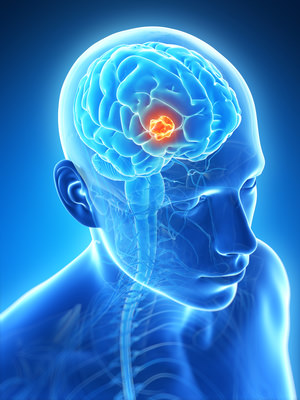 A diagram with blue man's brain